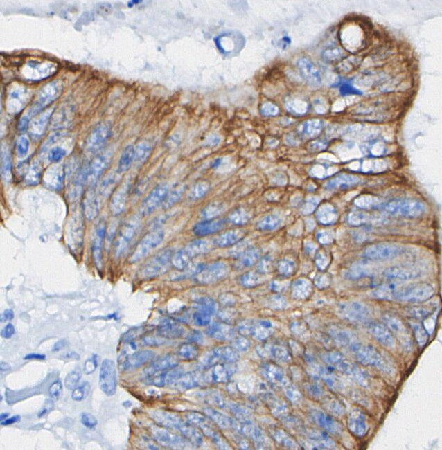 MMP3 Antibody