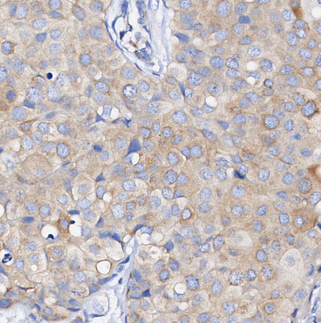 Phospho-Met/c-Met (Tyr1349) Antibody