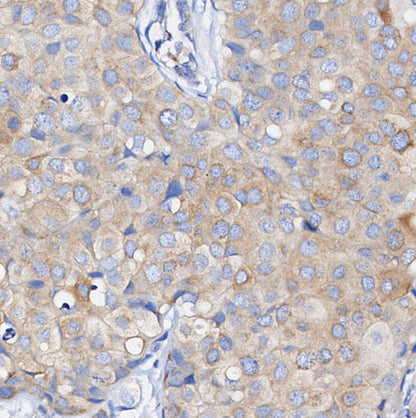 Phospho-Met/c-Met (Tyr1349) Antibody