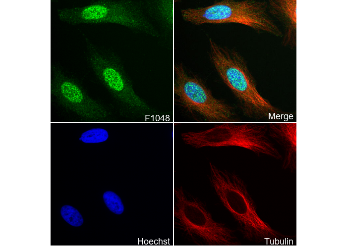 PIAS1 Antibody