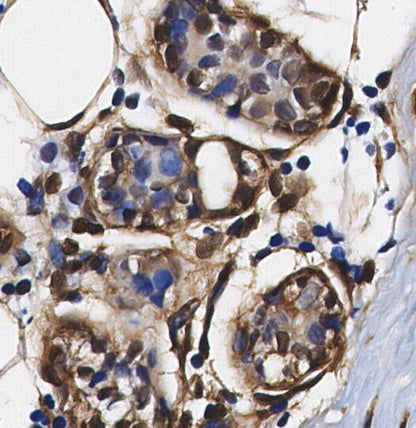 RBX1 Antibody