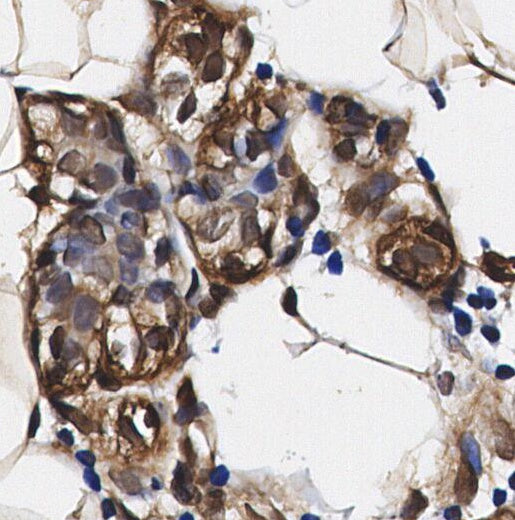 p18 INK4c/CDKN2C Antibody