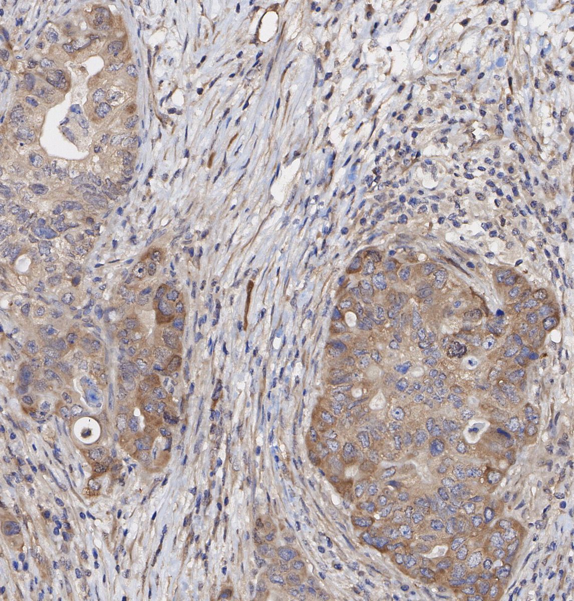 CAB39/MO25 Antibody