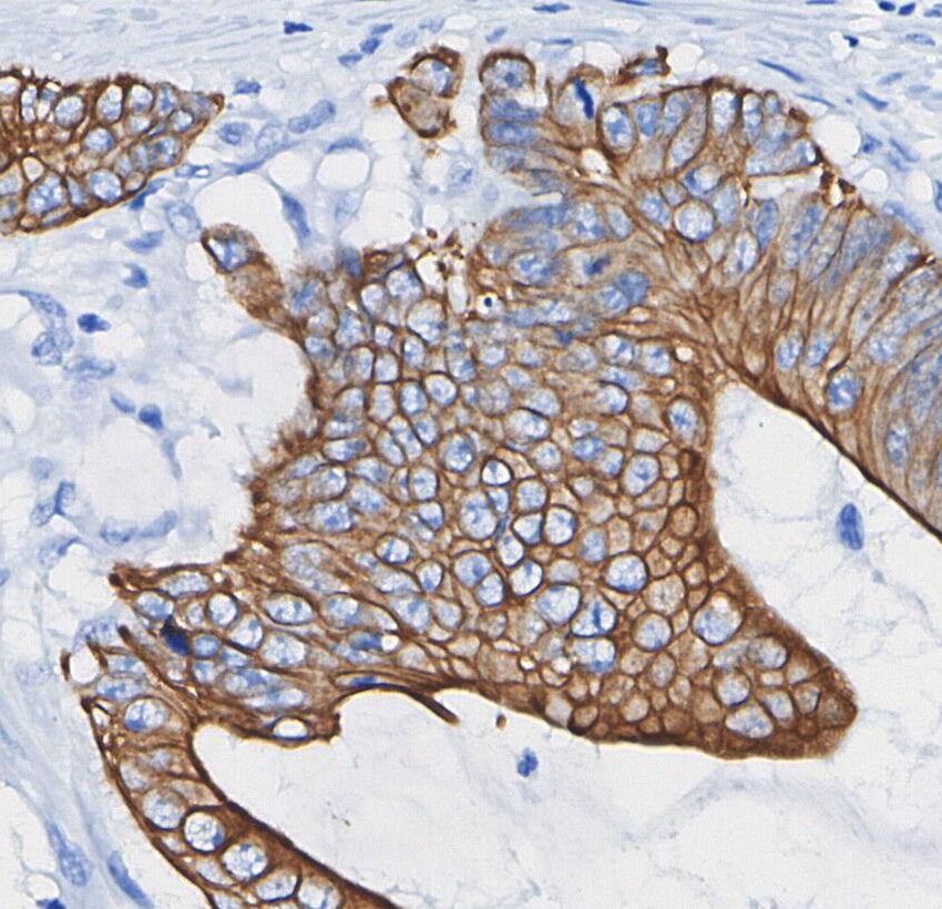 Cytokeratin 17 Antibody