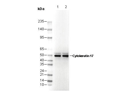 Cytokeratin 17 Antibody