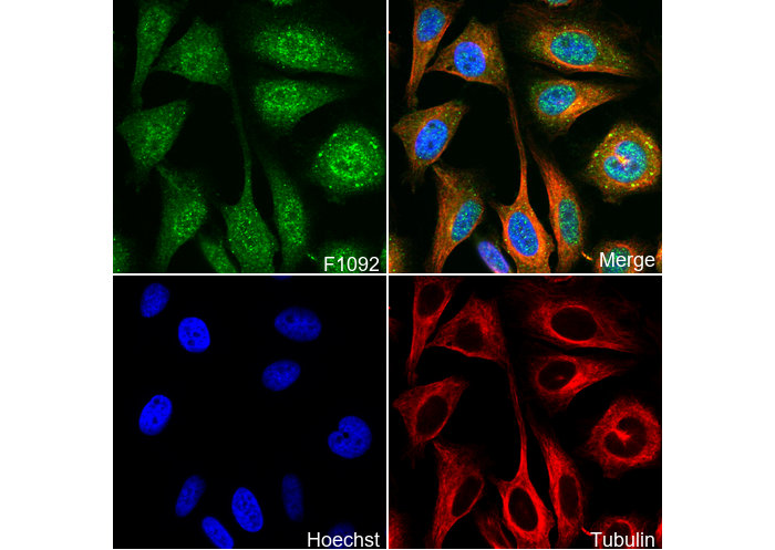 LIMK2 Antibody