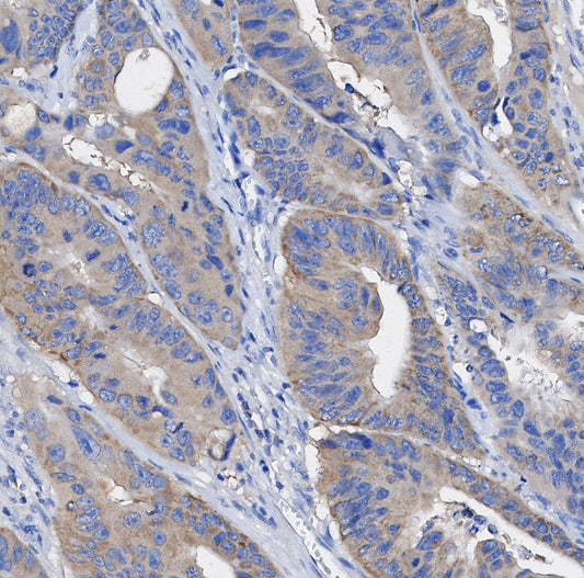 LIMK2 Antibody
