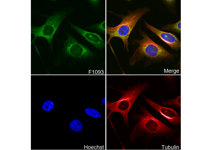 LYRIC/AEG1 Antibody