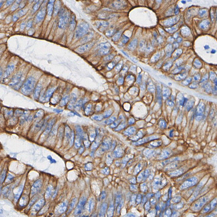 LYRIC/AEG1 Antibody
