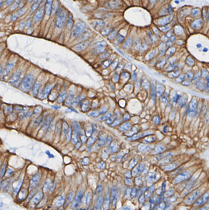 LYRIC/AEG1 Antibody