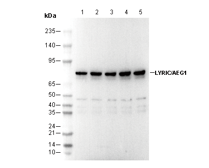 LYRIC/AEG1 Antibody