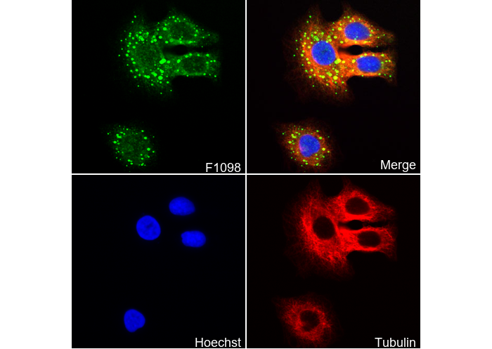 Myelin Basic Protein Antibody
