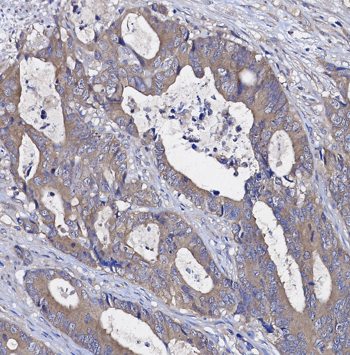 Neuropilin 1 Antibody