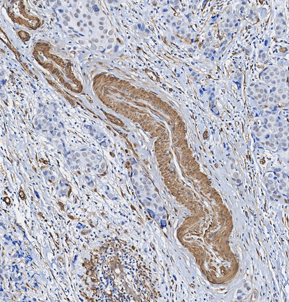SIRT2 Antibody