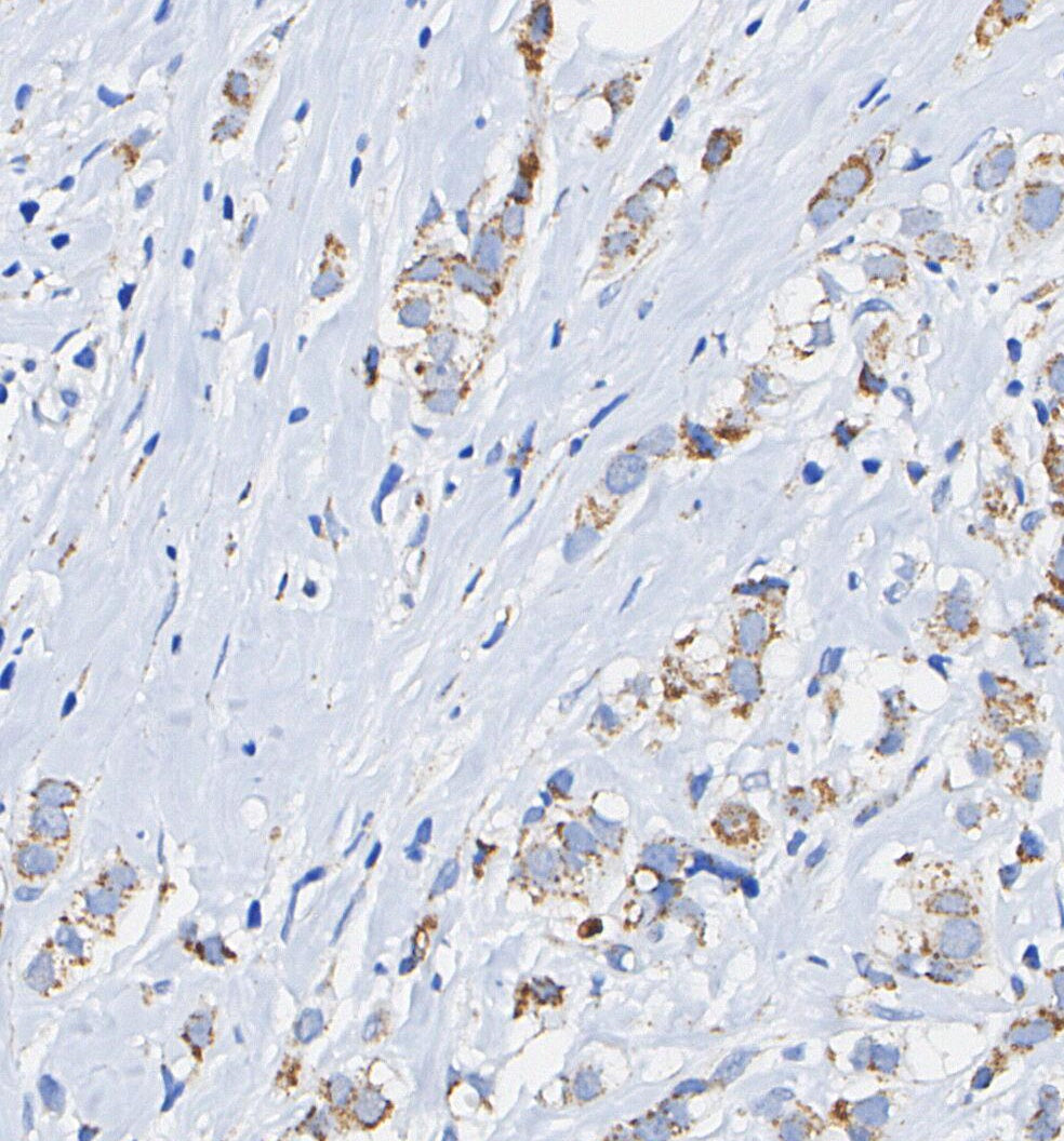 Phospho-Tau (Ser396) Antibody