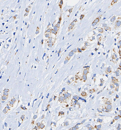 Phospho-Tau (Ser396) Antibody