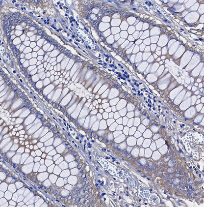 YB1 Antibody