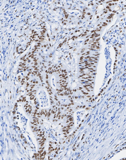 DDX5 Antibody