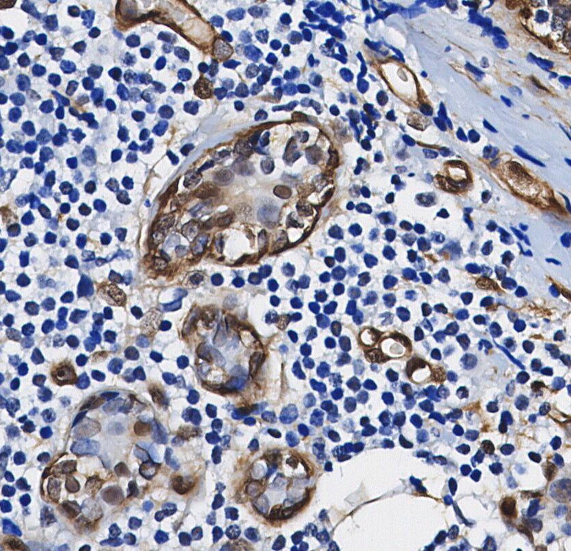 TXNRD1 Antibody