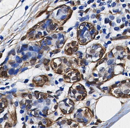 ERK1 Antibody