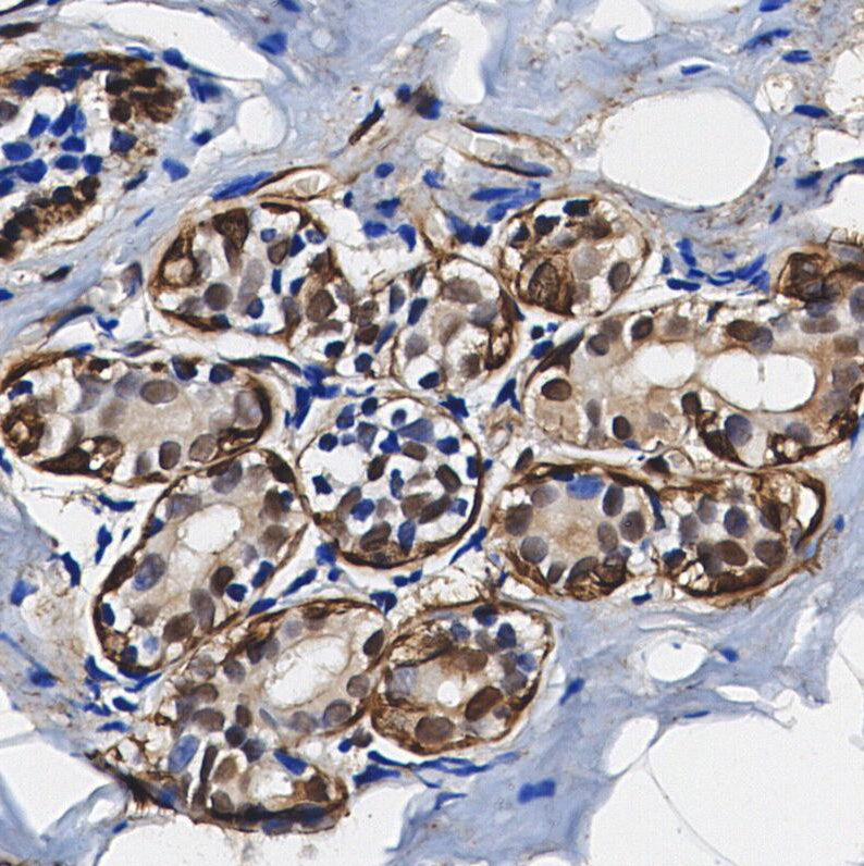 Phospho-FoxO3A (Ser253) Antibody