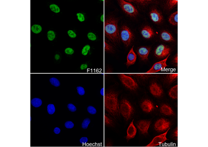 RPA70 Antibody