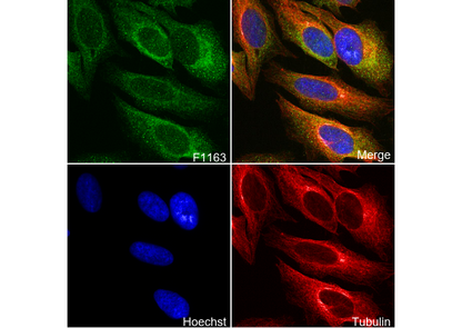 RRM2 Antibody
