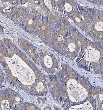 RRM2 Antibody