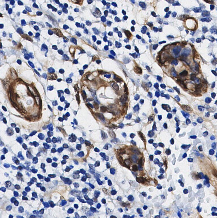 SENP1 Antibody