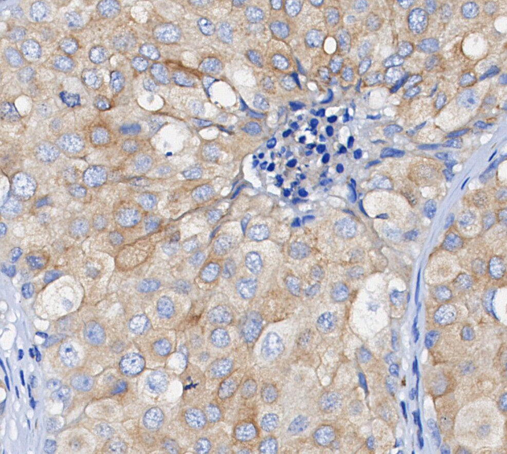 ATG9A Antibody
