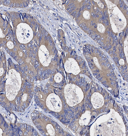 CDK5 Antibody