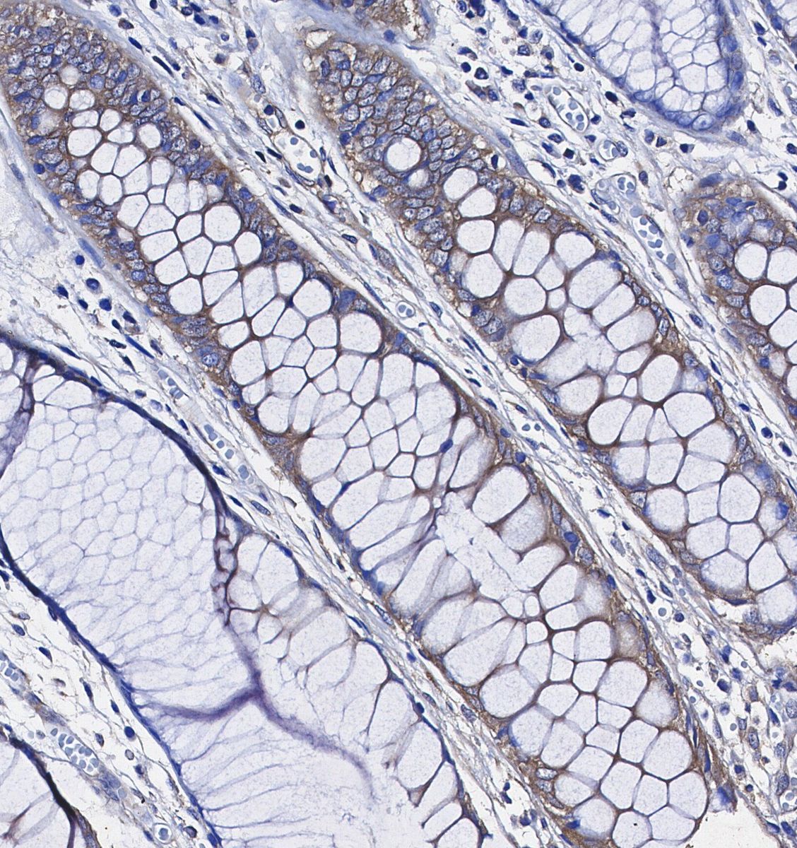 FXR1 Antibody