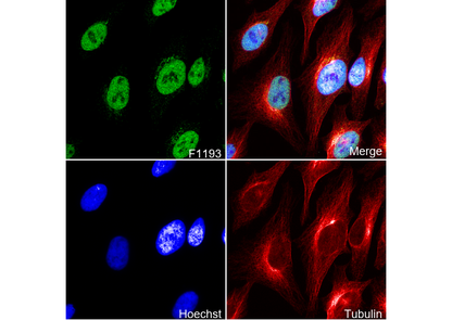 HMGA1 Antibody