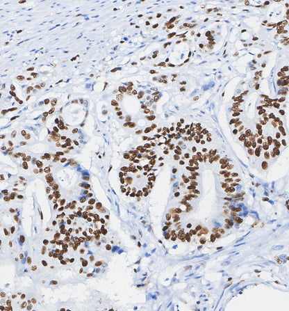 HMGA1 Antibody