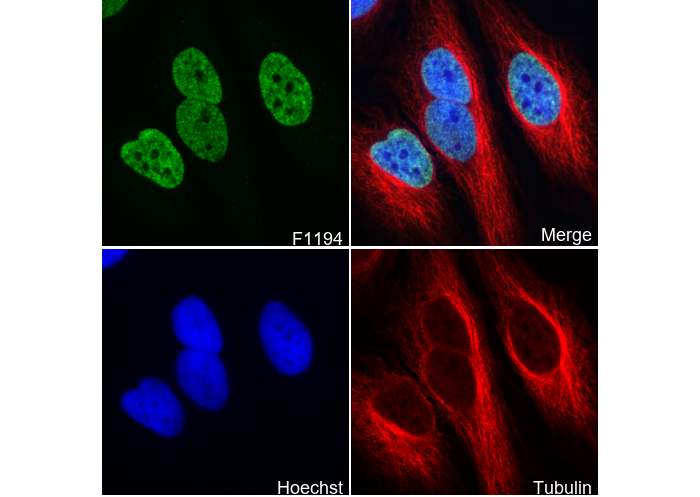 Histone H4 (acetyl Lys16) Antibody