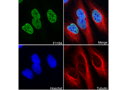 Histone H4 (acetyl Lys16) Antibody