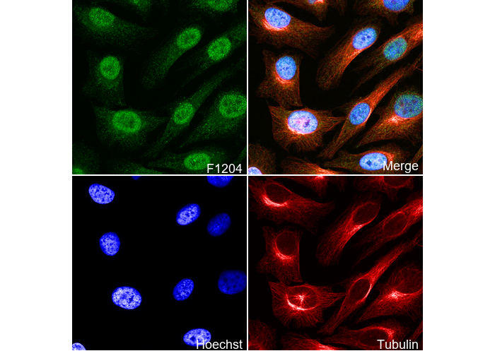 PFKFB3 Antibody