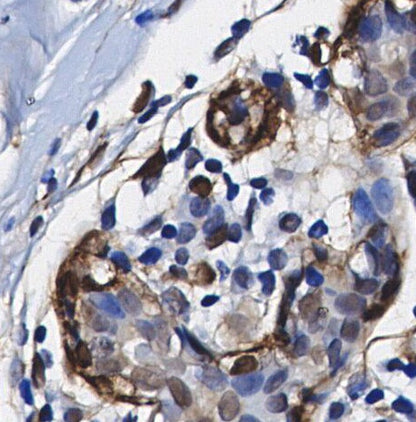 PFKFB3 Antibody