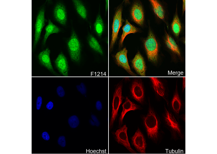 Superoxide Dismutase 1 Antibody
