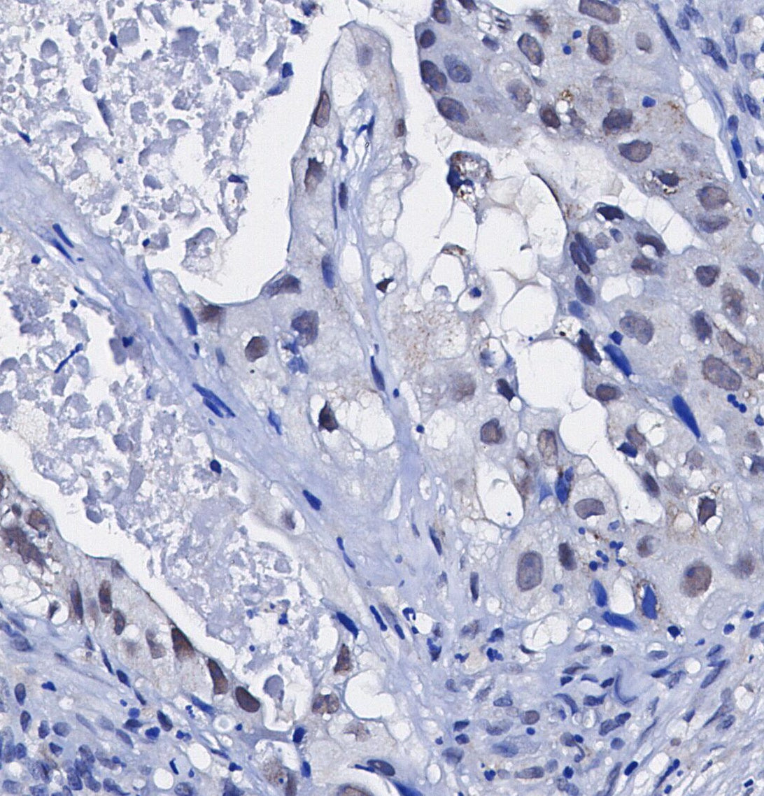Topoisomerase IIα Antibody
