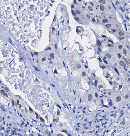 Topoisomerase IIα Antibody