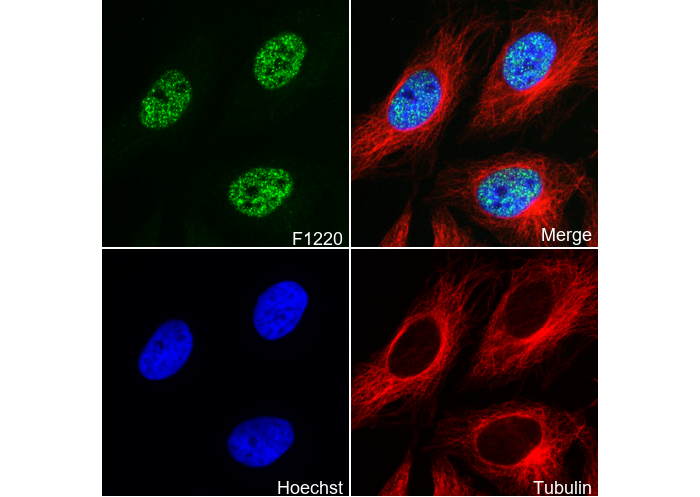 Phospho-c-Myc (Ser62) Antibody