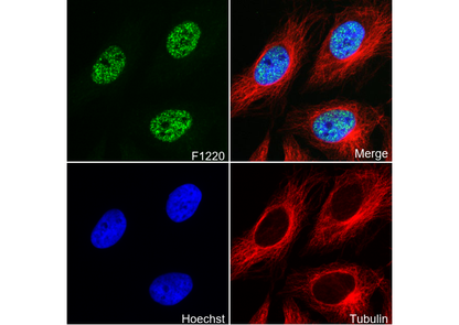 Phospho-c-Myc (Ser62) Antibody