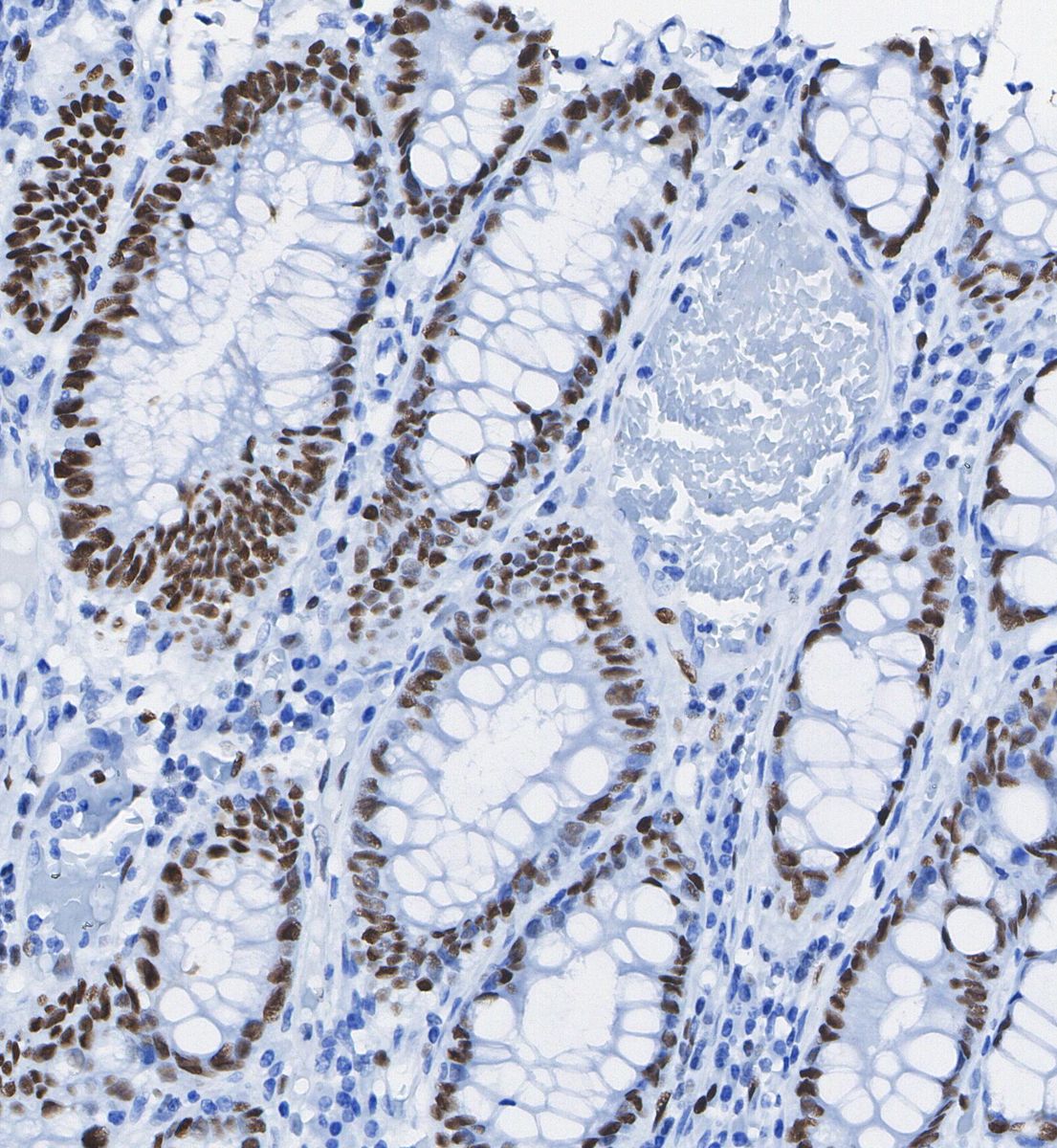 PP2C-α Antibody
