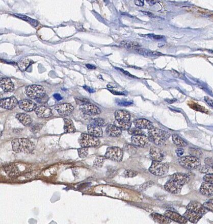HDAC7 Antibody