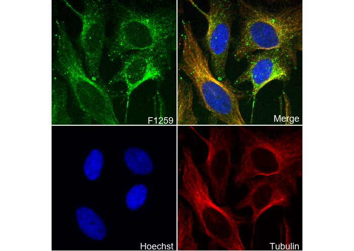 Phospho-MARCKS (Ser167/170) Antibody