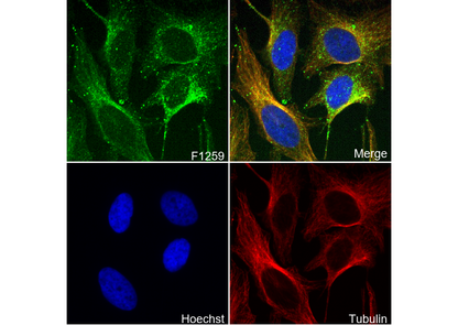 Phospho-MARCKS (Ser167/170) Antibody