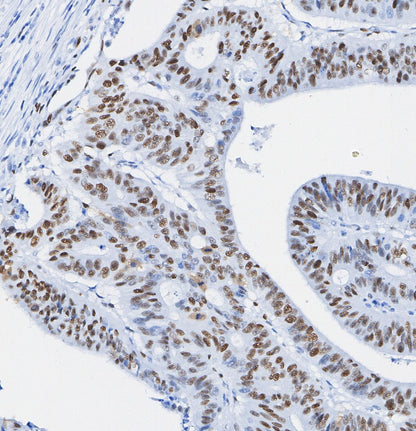 SMARCB1/BAF47 Antibody