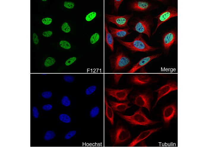 Acetyl-Histone H2B (Lys5) Antibody