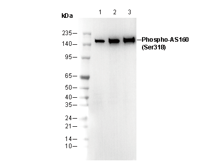 Phospho-AS160 (Ser318) Antibody